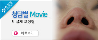 비절개 노스카 …