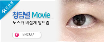 노스카 비절개 …