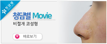 [비절개코성형]…