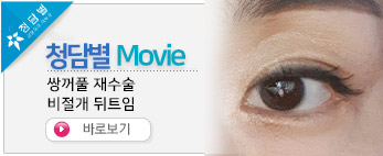 쌍꺼풀 재수술 …