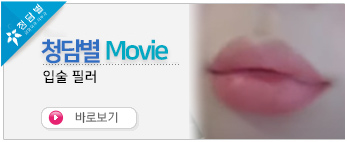 입술필러 전후…