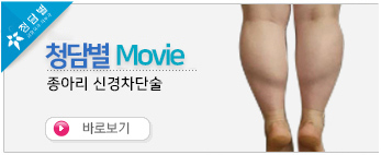 종아리 신경차…