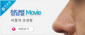 비절개코성형 …