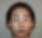 18.01.03 - 이물질…
