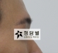 비절개 코성형 …