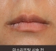 비절개입꼬리…