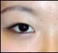 쌍꺼풀 before&aft