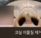 [실이물질제거]…