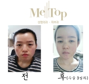 아큐스컬프+코+…