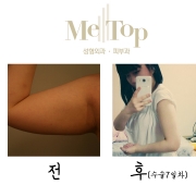 초콜릿테라피 …