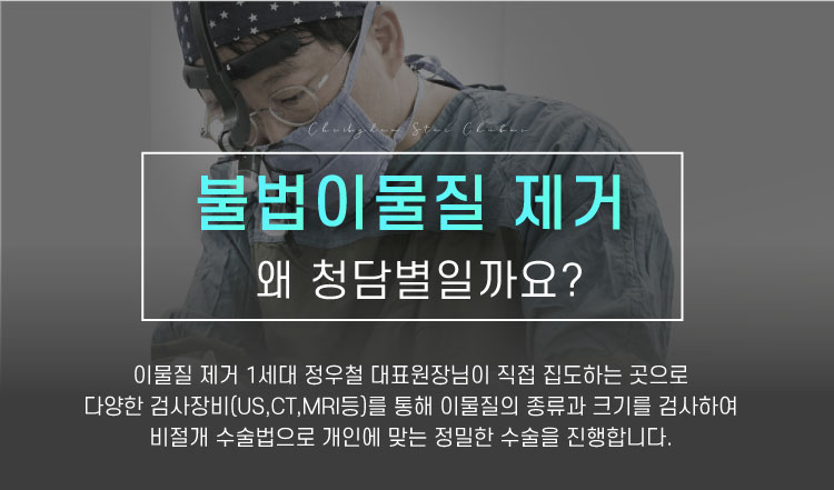 필러제거