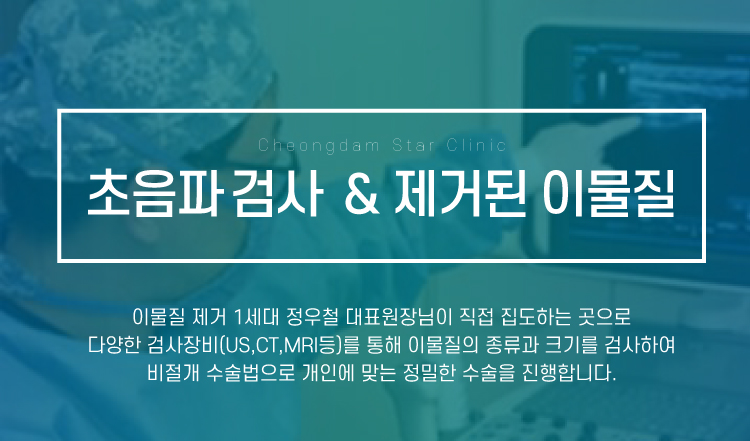 지방이식제거